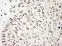 APRIN Antibody, Novus Biologicals 0.1mL; Unlabeled:Antibodies, Polyclonal